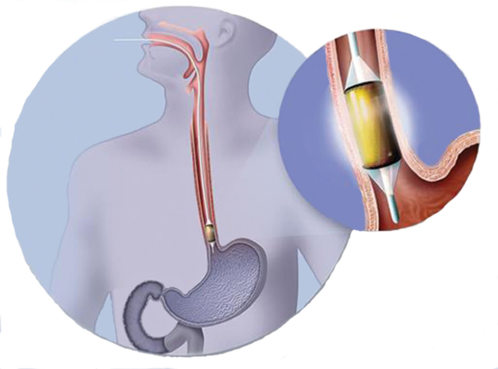 Journal of Lancaster General Health Journal of Lancaster General Hospital